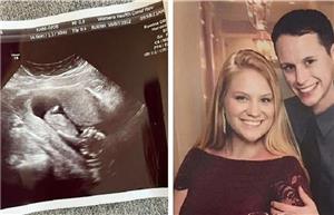 زن آمریکایی ۲ سال بعد از مرگ شوهرش از او باردار شد!
